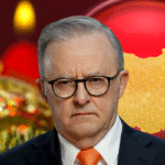 Anthony Albanese FNGN